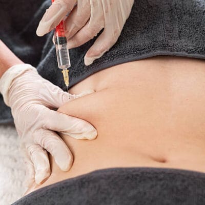 Is-Fat-Melting-Injections-Suitable-for-People-With-Sensitive-Skin
