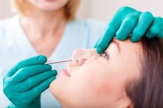 Rhinoplasty-in-Dubai-9-1
