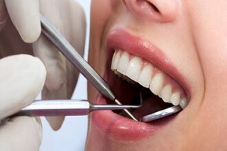 Teeth-Cleaning-and-Polishing-in-Riyadh