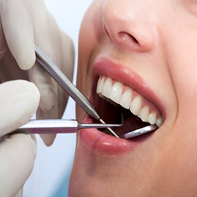 Teeth-Cleaning-and-Polishing-in-Riyadh