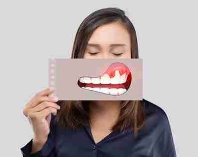 The-Right-Gum-Choice-Helps-Prevent-Cavities-During-Braces_11zon