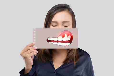 The-Right-Gum-Choice-Helps-Prevent-Cavities-During-Braces_11zon