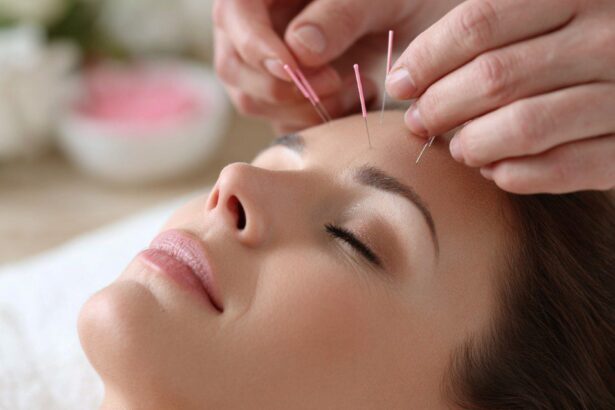 facial-acupuncture-treatment