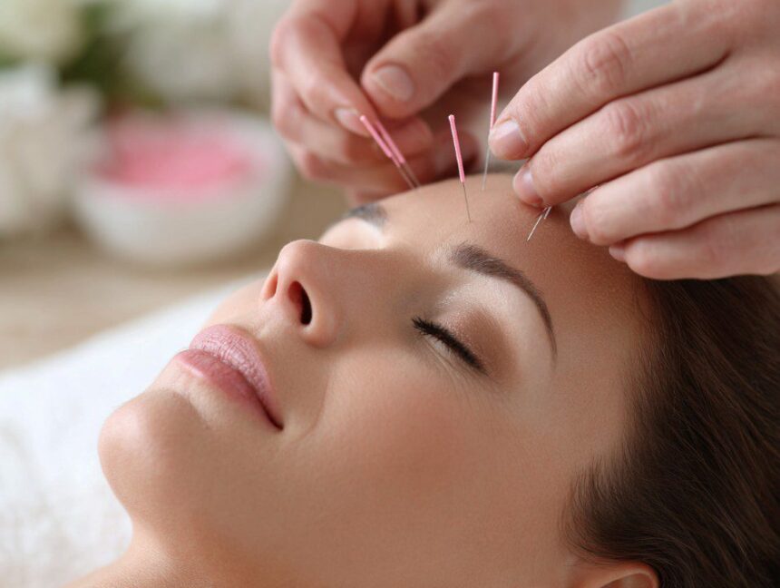 facial-acupuncture-treatment