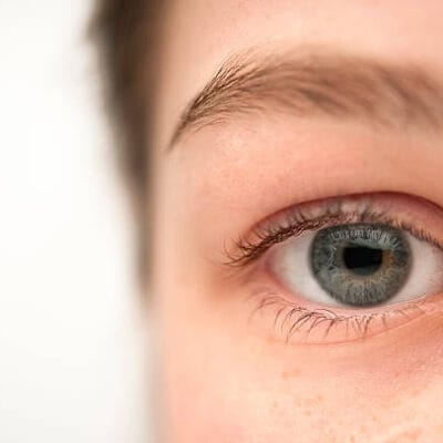 Can-Eyelid-Surgery-Address-Loose-Upper-Eyelids