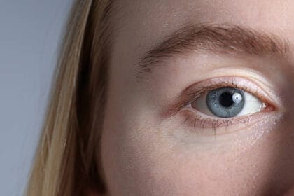 Can-Eyelid-Surgery-Fix-Uneven-Eyelids