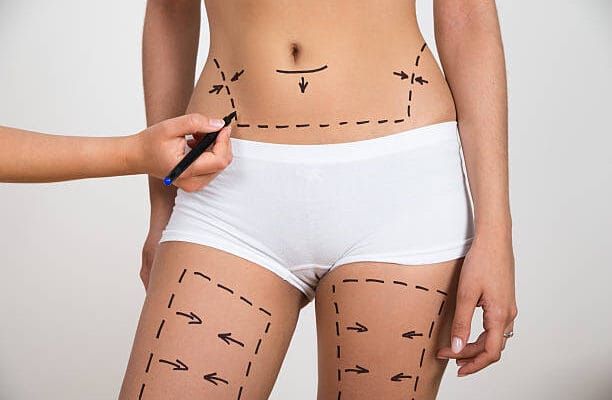 Can-Liposuction-Boost-Self-Esteem-Quickly