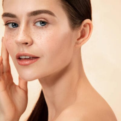Can-Melasma-Treatment-Lighten-Skin-Tone