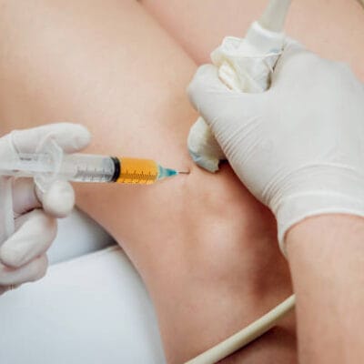Can-PRP-injections-for-knees-reduce-inflammation
