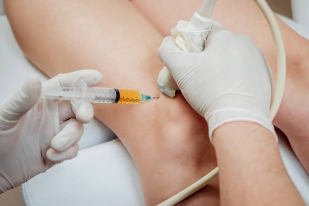 Can-PRP-injections-for-knees-reduce-inflammation