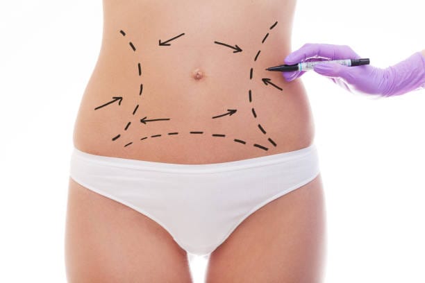 Can-Tummy-Tuck-Tighten-Sagging-Skin-Quickly