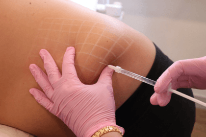 Do-Fat-Melting-Injections-Improve-Body-Shape