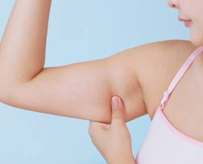 Do-Fat-Melting-Injections-Work-for-Arm-Fat-Reduction