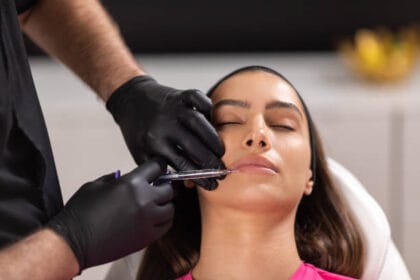Do-Russian-Lip-Fillers-Stretch-the-Lips-Permanently
