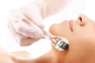 Does-Derma-Roller-Treatment-Improve-Skin-Texture