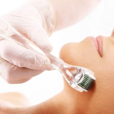Does-Derma-Roller-Treatment-Improve-Skin-Texture