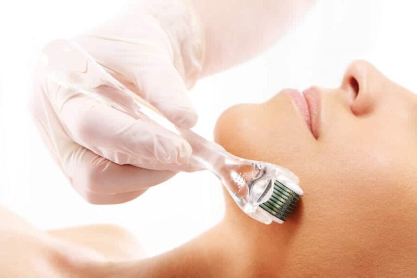 Does-Derma-Roller-Treatment-Improve-Skin-Texture