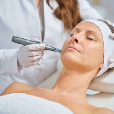 Does-Dermapen-Microneedling-improve-skin-texture