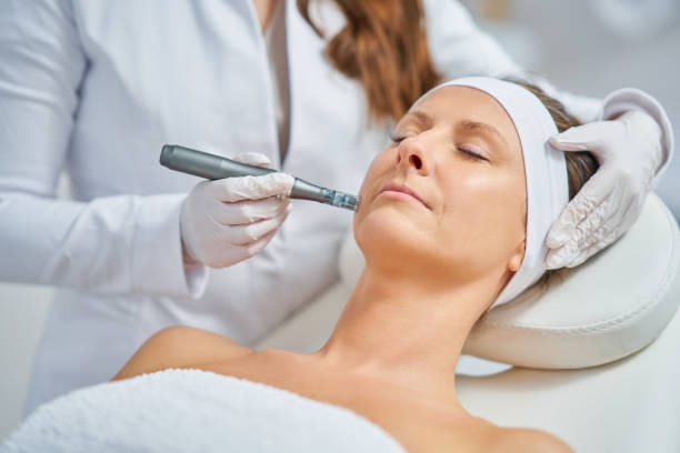 Does-Dermapen-Microneedling-improve-skin-texture