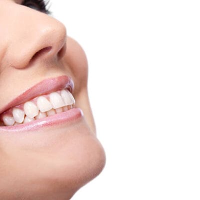 Does-E-Max-Veneers-Change-the-Shape-of-Your-Teeth