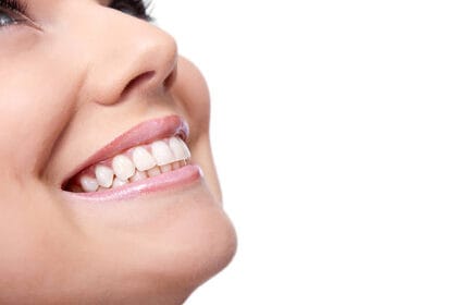 Does-E-Max-Veneers-Change-the-Shape-of-Your-Teeth