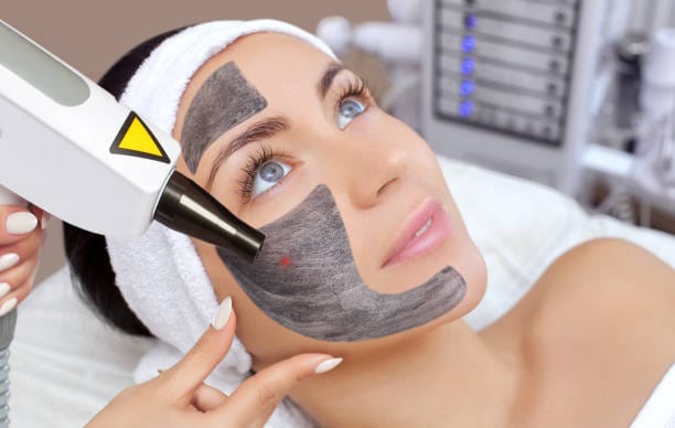 Does-Laser-Carbon-Peel-help-control-excess-oil
