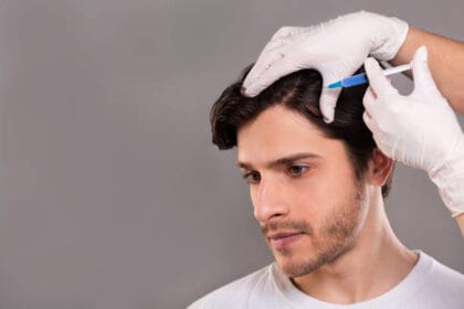 Does-Stem-Cell-Hair-Transplant-Work-on-Crown-Hair-Loss-Well