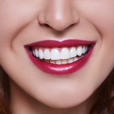 Does-Teeth-Whitening-Help-Remove-Coffee-and-Tea-Stains