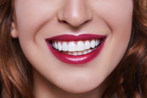 Does-Teeth-Whitening-Help-Remove-Coffee-and-Tea-Stains