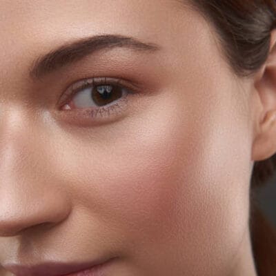 Does-Under-Eye-Fillers-Require-Downtime