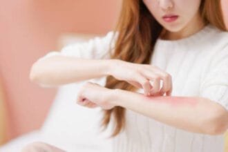 How-Does-Eczema-Treatment-Improve-Skin-Health