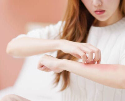 How-Does-Eczema-Treatment-Improve-Skin-Health