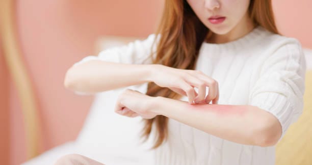 How-Does-Eczema-Treatment-Improve-Skin-Health