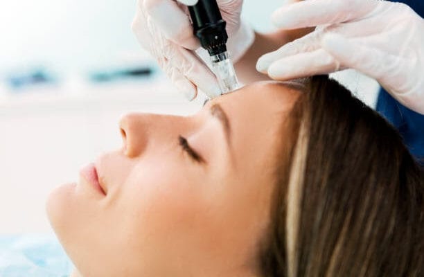 How-Does-Microneedling-Support-Natural-Skin-Healing