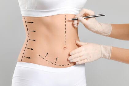 How-Does-a-Tummy-Tuck-Benefit-Your-Health-Overall