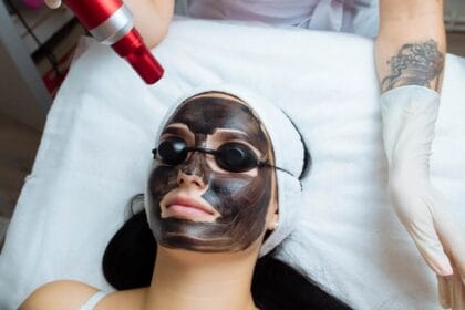 How-Laser-Carbon-Peel-Reduces-Large-Pores