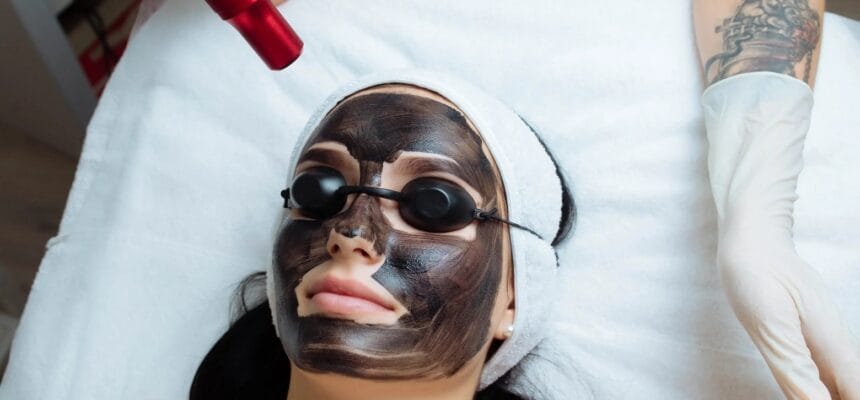 How-Laser-Carbon-Peel-Reduces-Large-Pores