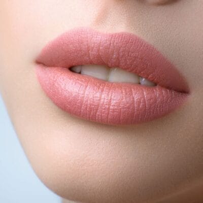 How-Lip-Fillers-Injection-Creates-Natural-Volume
