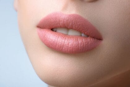 How-Lip-Fillers-Injection-Creates-Natural-Volume