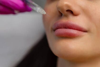 How-Often-Can-You-Safely-Get-Lip-Fillers-Injection