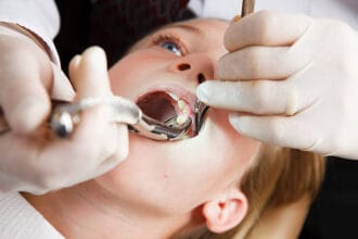 How-Soon-Can-You-Recover-From-Tooth-Removal