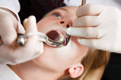 How-Soon-Can-You-Recover-From-Tooth-Removal