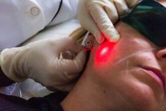 Is-EndoLift-Safe-for-Facial-Rejuvenation