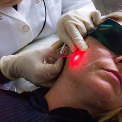 Is-EndoLift-Safe-for-Facial-Rejuvenation