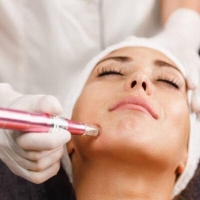 Is-Microneedling-Suitable-for-All-Skin-Tones