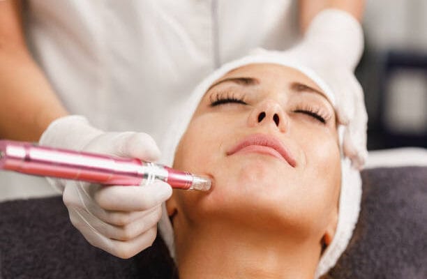 Is-Microneedling-Suitable-for-All-Skin-Tones