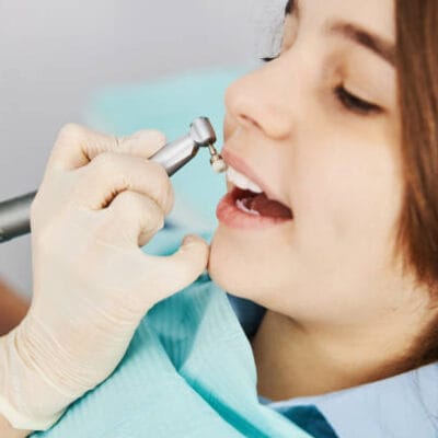 Is-Teeth-Cleaning-a-Helpful-Step-Before-Whitening-Treatment