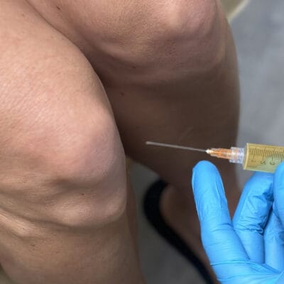 Knee-Pain-Recovery-Starts-with-PRP-Injections