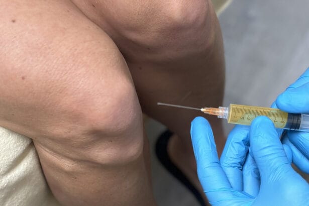 Knee-Pain-Recovery-Starts-with-PRP-Injections