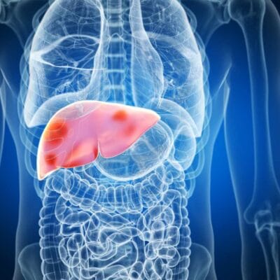 Liver-image-13c8379a99ff4eb7a0c4c7257cefa87d-2048x1024-1